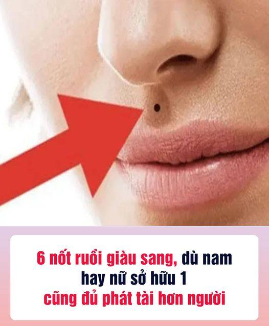 6 nốt ruồi giàu sang, dù nam hay nữ sở hữu 1 cũng đủ phát tài hơn người