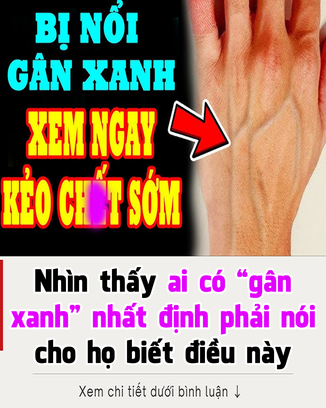 Nhìn thấy ai có “gân xanh” nhất định phải nói cho họ biết điều này, vì sẽ cứu sống họ đấy