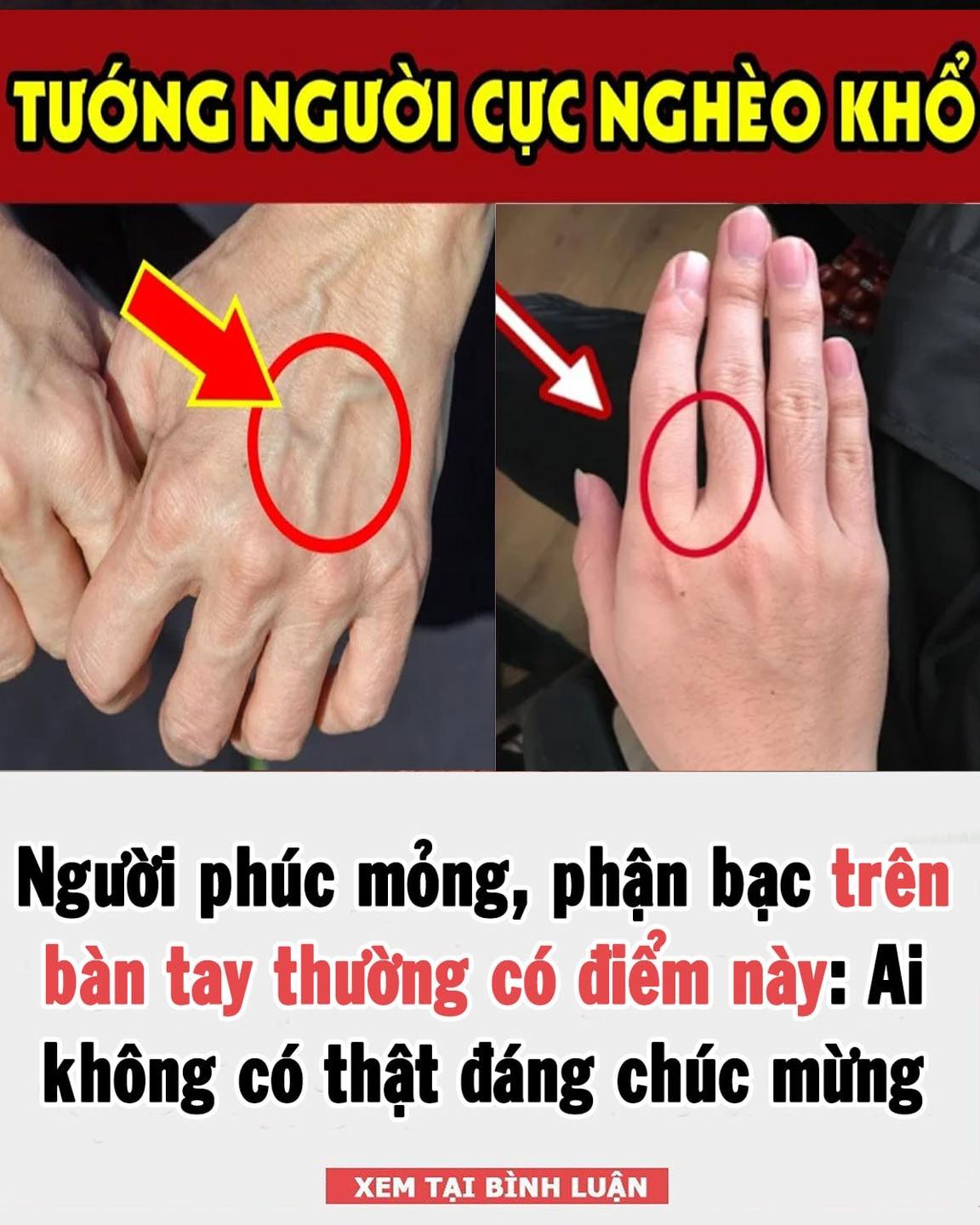 Người phúc mỏng, phận bạc trên bàn tay thường có điểm này: Ai không có thật đáng chúc mừng